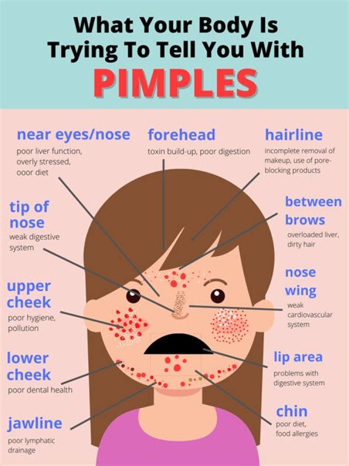 Why am I getting pimple like bumps on my body?