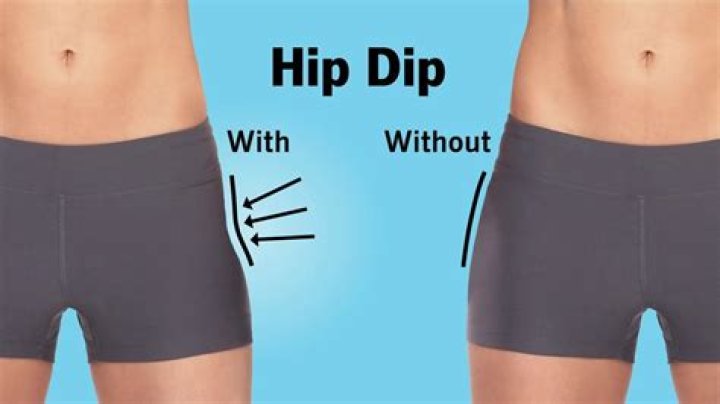 Why are my hips so tight after running?