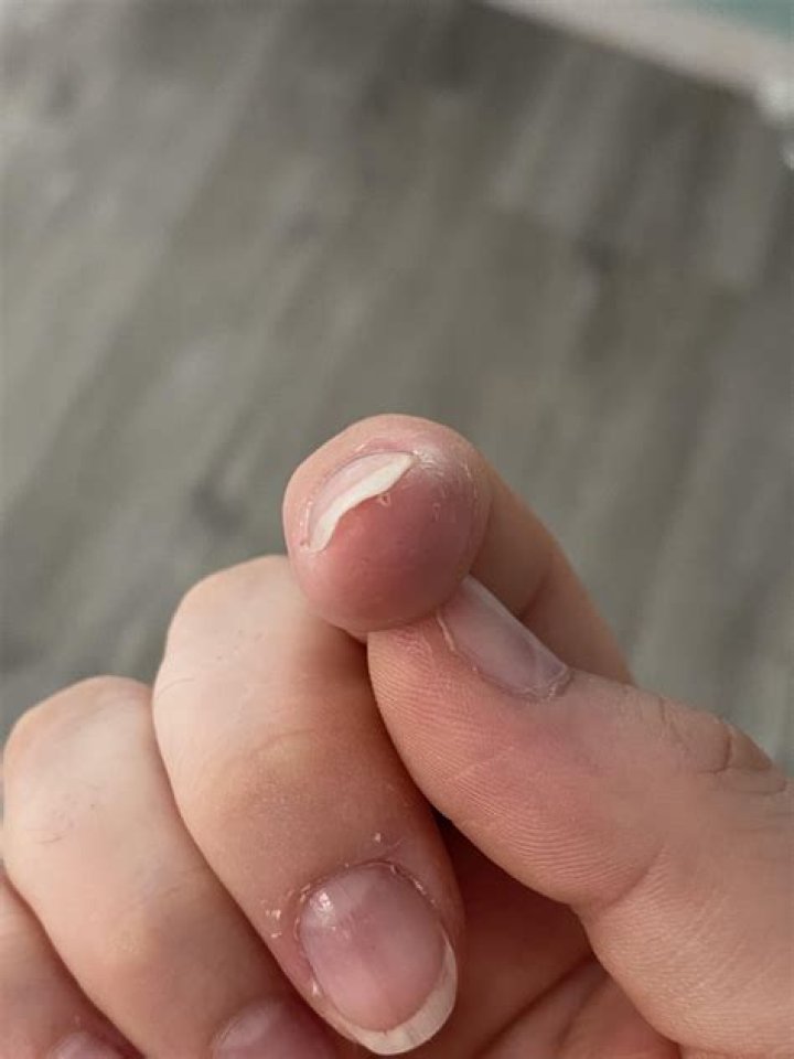 Why are my nails so thin and bendy?