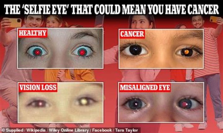 Why did Bella have red eyes?