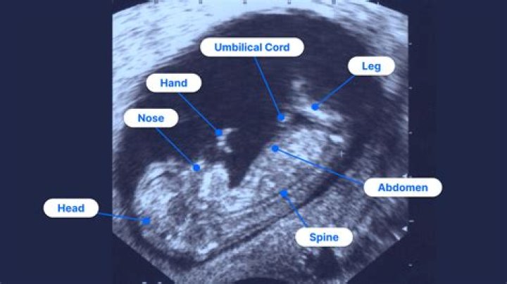 Why do babies hide during ultrasound?
