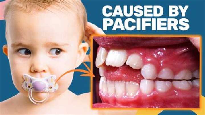 Why do hospitals not give pacifiers?