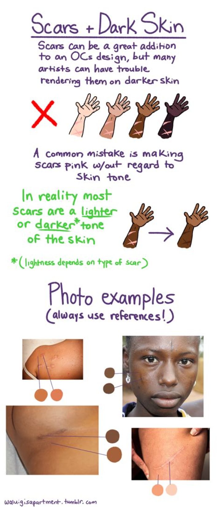 Why do scars turn dark?