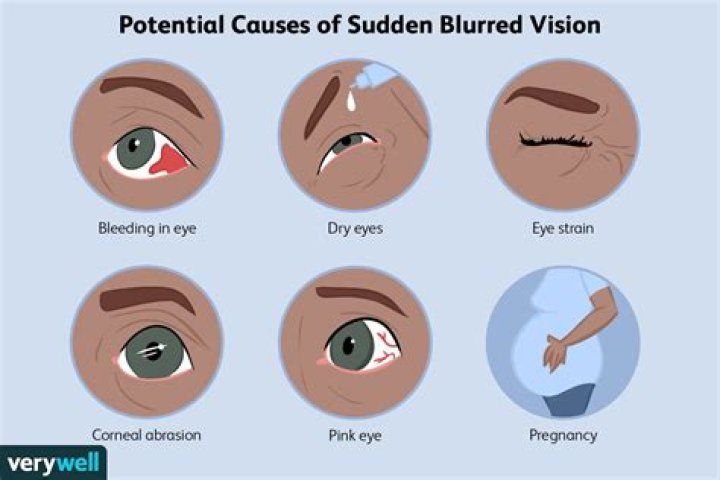 Why does my eyesight keep getting worse?