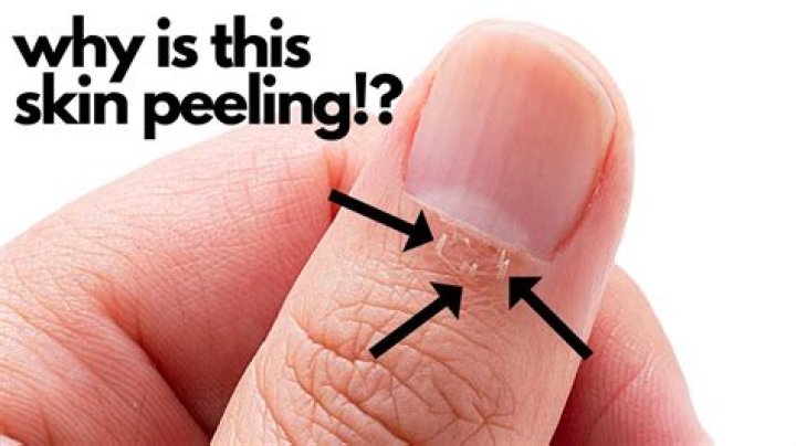 Why is my child picking his nails?
